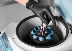 Plasmolifting process. Preparation of blood for injections. Cosmetologist in black rubber glove puts tube of blood in centrifuge. Top view. Concept of beauty and health